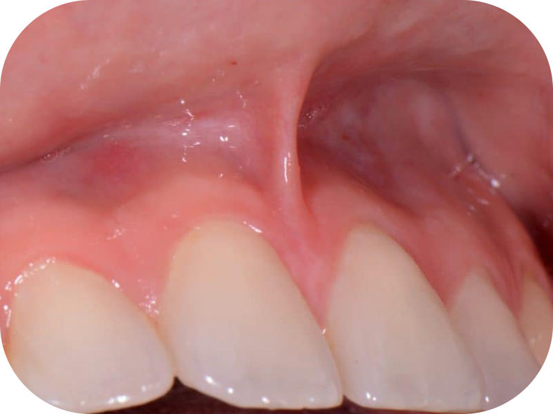 Frenecnomia